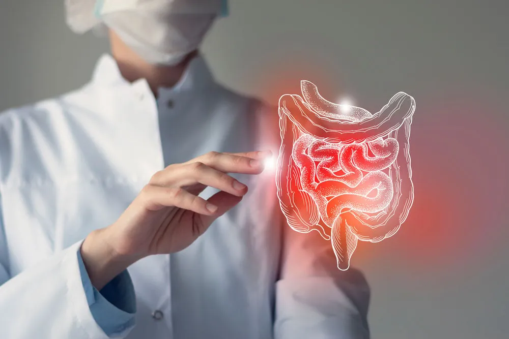 باحثون يحلون لغزا استمر أكثر من 30 عاما في أمراض الأمعاء الالتهابية